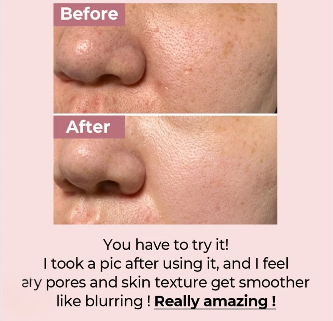 Numbizin - No.3 Tingle -Pore Softening Sheet Mask